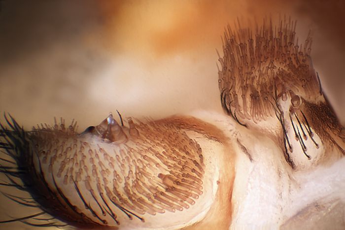 Creepy Microscope Close-Ups (17 pics) Creepy Microscope Close-Ups (17 pics)