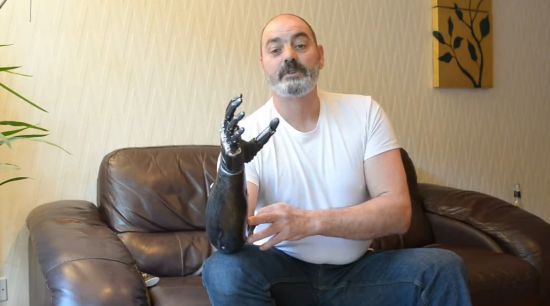 Incredible Mechanical Right Hand