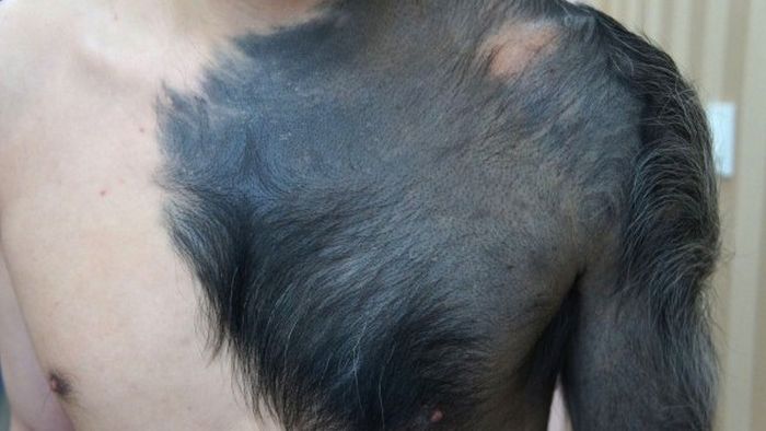 Real Life Werewolf (6 pics)