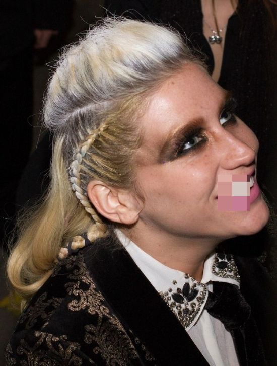 Ke$ha with a Half-White Hair and a Gold Tooth (2 pics)