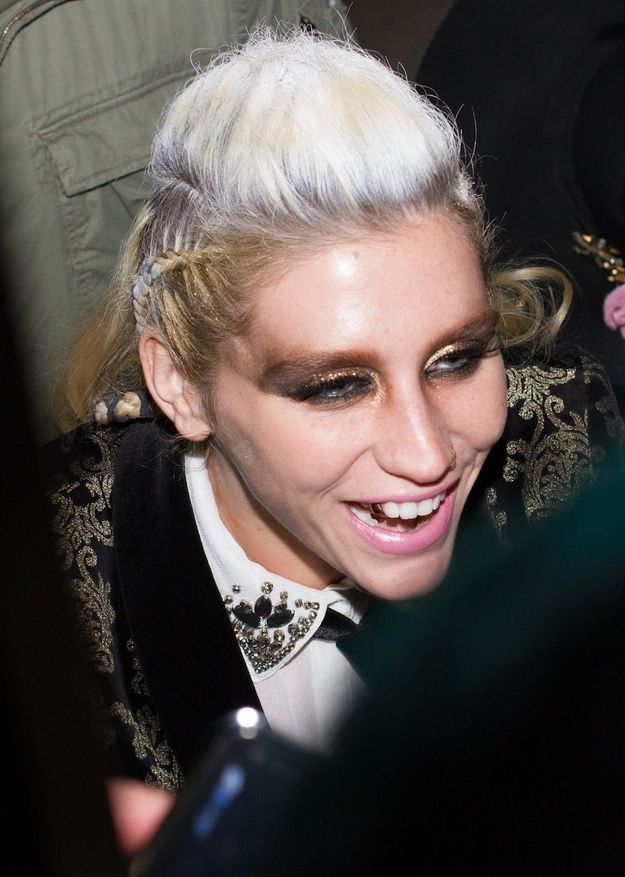 Ke$ha with a Half-White Hair and a Gold Tooth (2 pics)