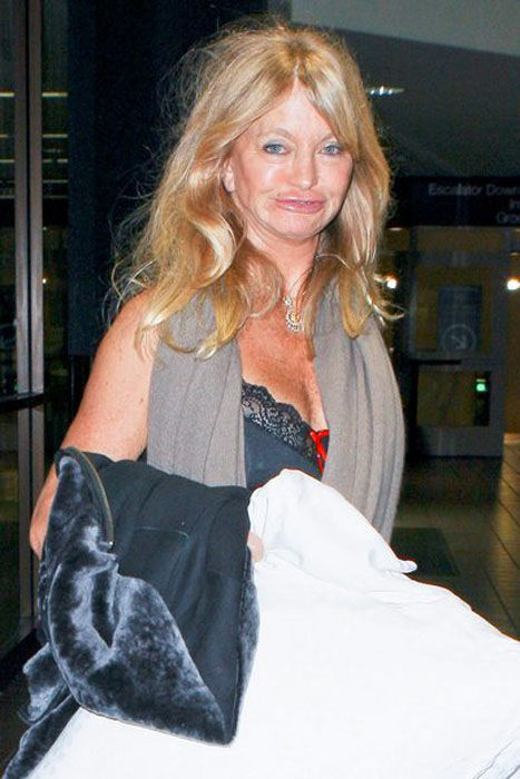Goldie Hawn's Face Looks Bad (6 pics)