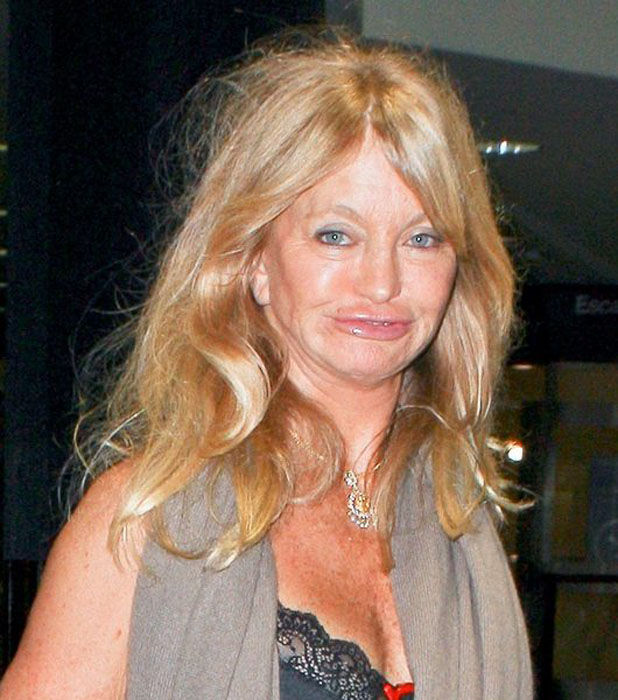 Goldie Hawn's Face Looks Bad (6 pics)