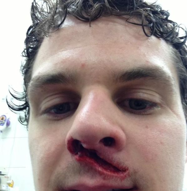 Hit by a Puck (5 pics)