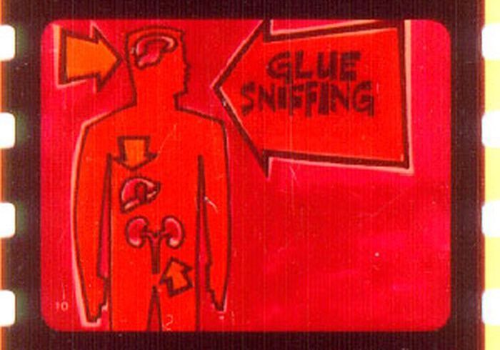Glue Sniffing and Pills (59 pics)