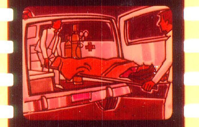 Glue Sniffing and Pills (59 pics)