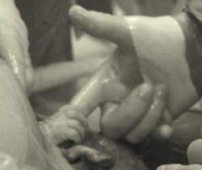 Handshake from the Womb (3 pics)