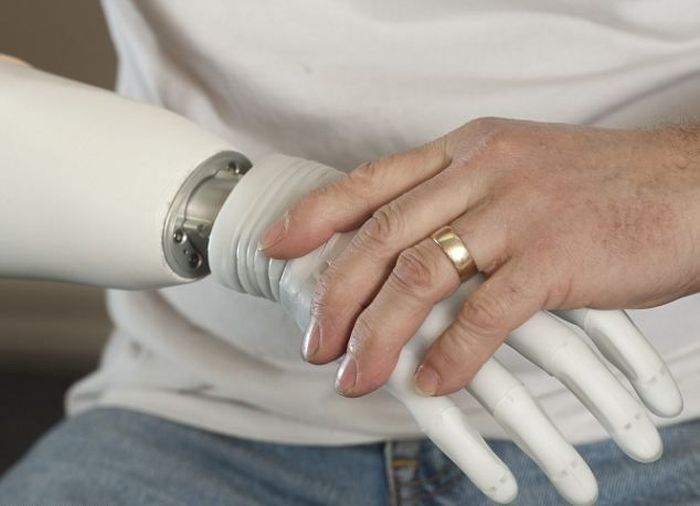 Bionic Arm (10 pics)