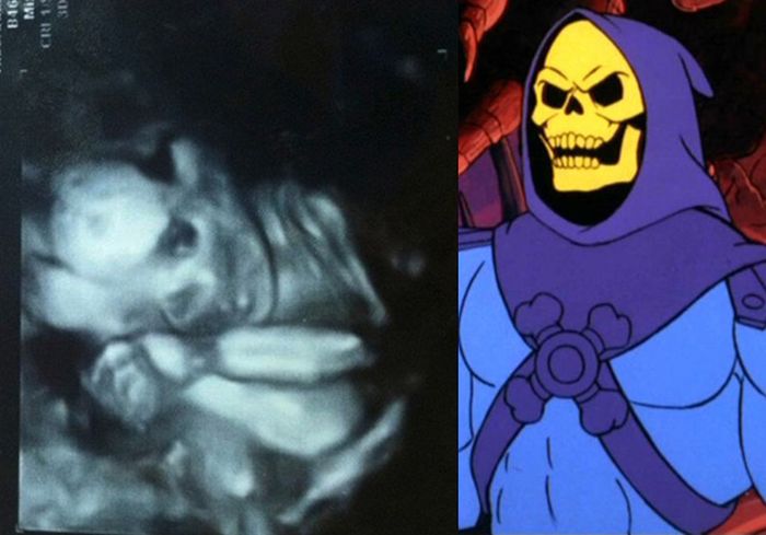 Babies in Ultrasound Who Look Like Fictional Characters. Part 2 (10 pics)