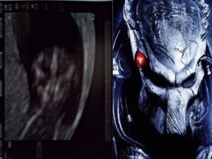 Babies in Ultrasound Who Look Like Fictional Characters. Part 2 (10 pics)