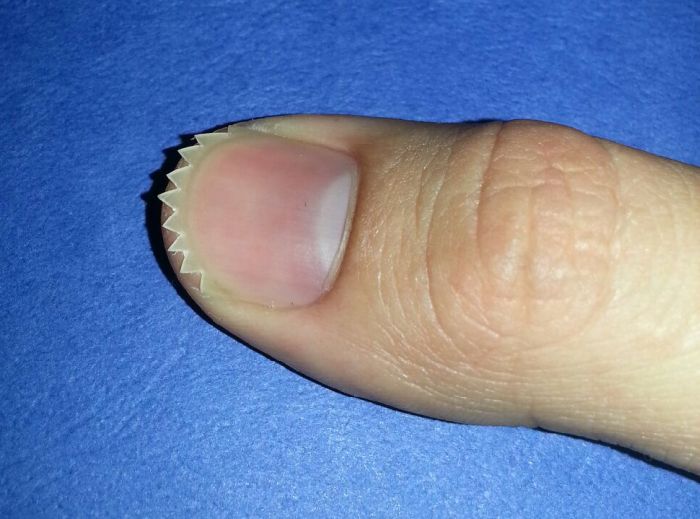 Acid Picdump (128 pics)