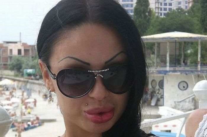 Girls With Silicone Lips. Part 3 (75 pics)