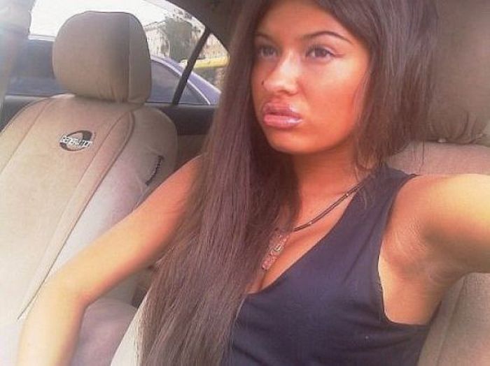 Girls With Silicone Lips. Part 3 (75 pics)