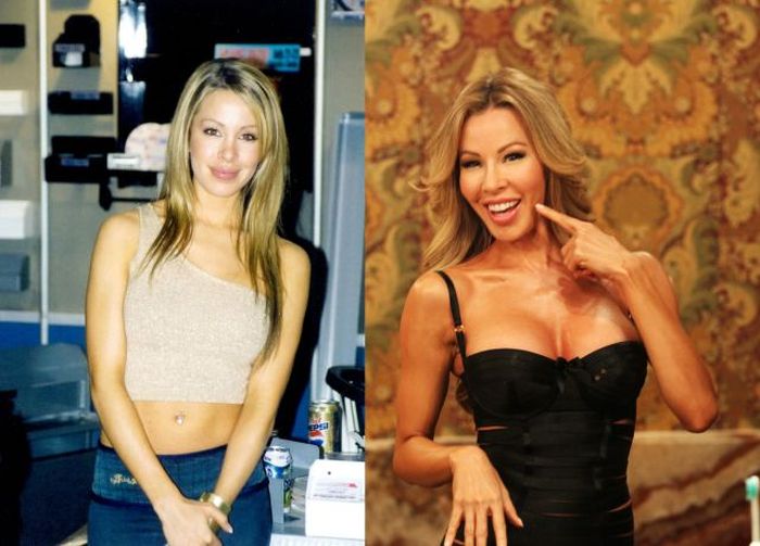 Lisa Hochstein Before and After Plastic Surgeries (35 pics)