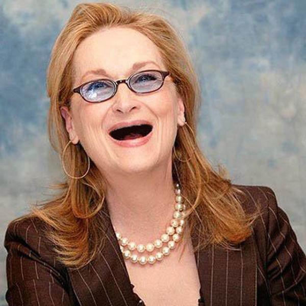 Actresses without Teeth (41 pics)