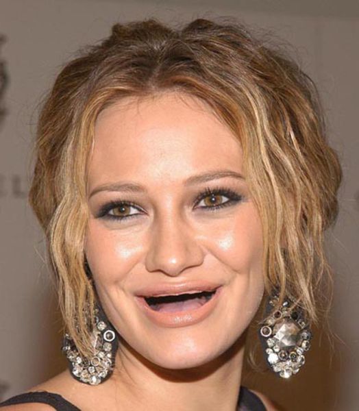 Actresses without Teeth (41 pics)