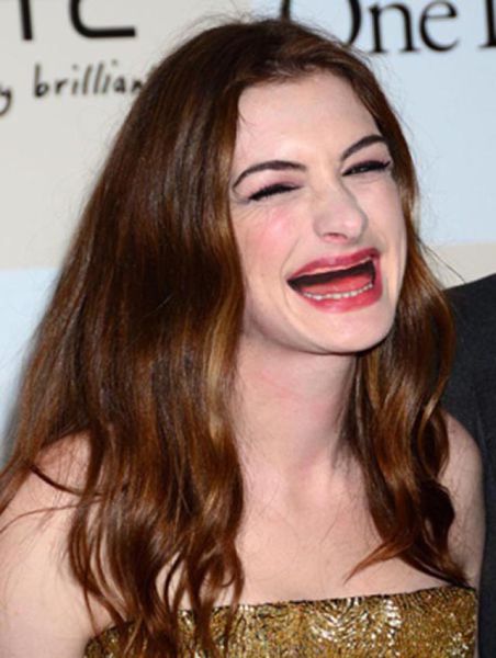 Actresses without Teeth (41 pics)