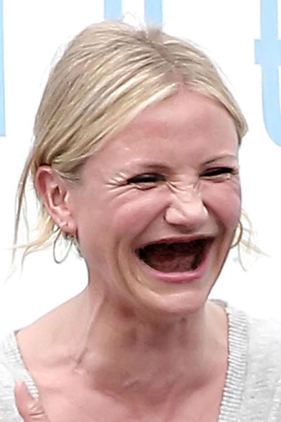 Actresses without Teeth (41 pics)