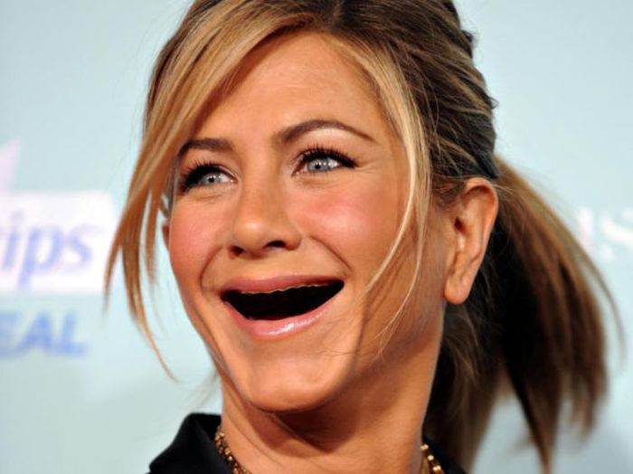 Actresses without Teeth (41 pics)