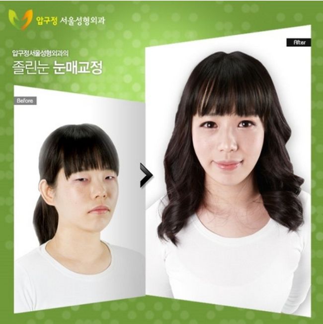 Korean Plastic Surgery (31 pics)