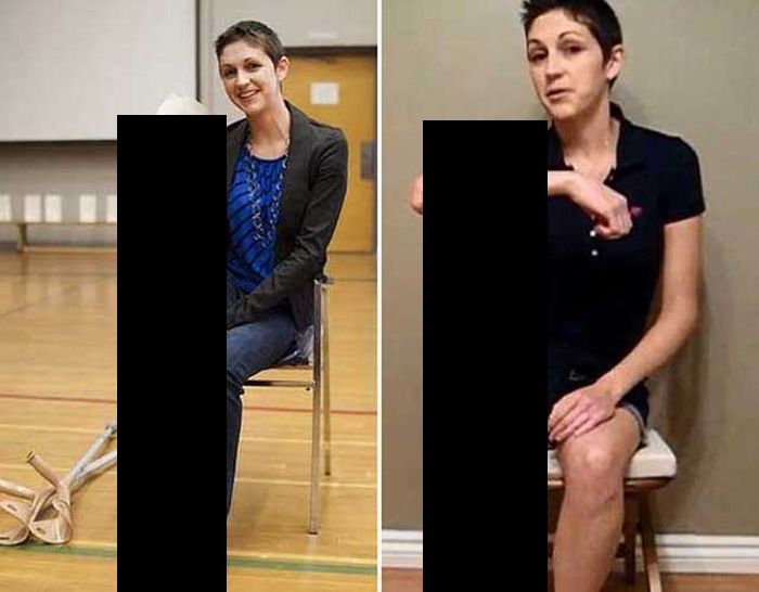 Woman Can Rotate Her Leg 180 Degrees (2 pics + video)