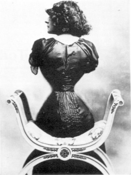 X-Rays Of Women Wearing Corsets (5 pics)