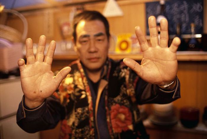 Prosthetic Pinkies for the Yakuza (5 pics)