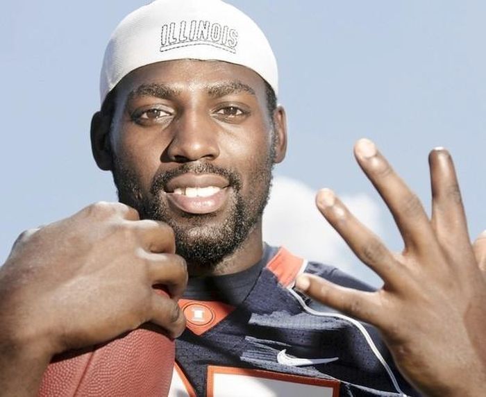 Athletes with Deformed Fingers (14 pics)
