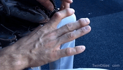 Athletes with Deformed Fingers (14 pics)