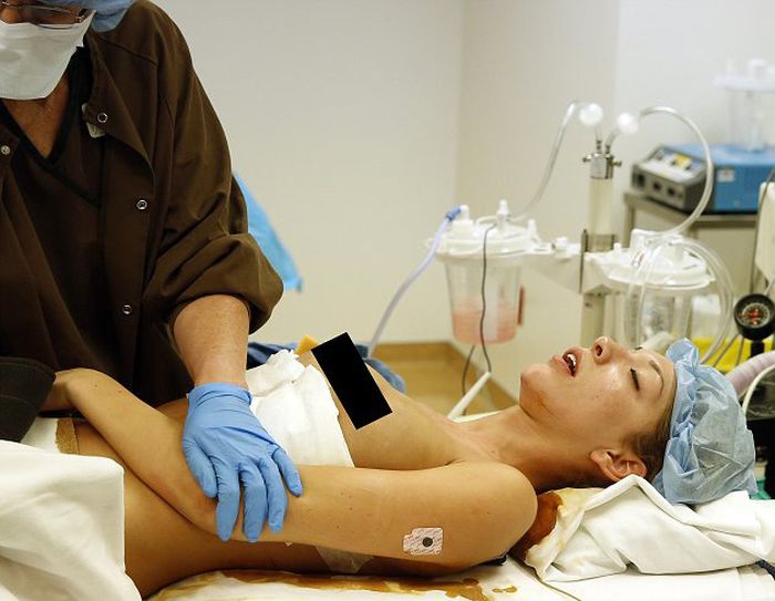 Breast Enlargement. How It's Done (20 pics)