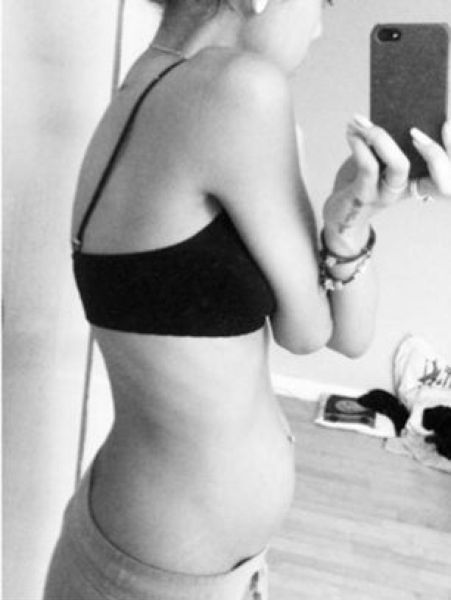 Anorexic Pregnant Girl (21 pics)