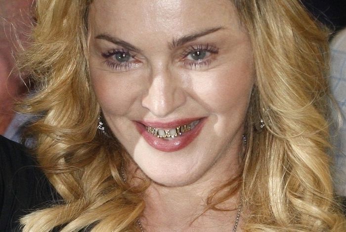 Madonna's Grillz (7 pics)