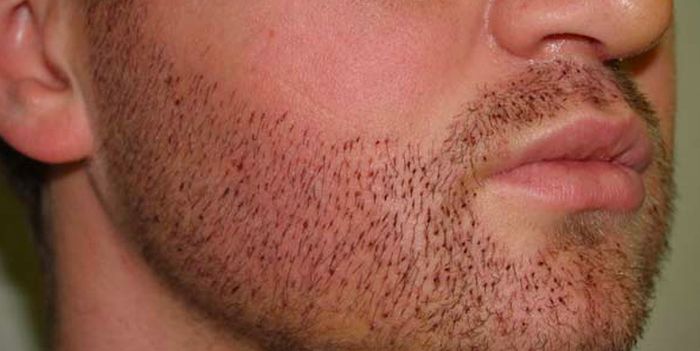 Bizarre Plastic Surgery Procedures (14 pics) Bizarre Plastic Surgery Procedures (14 pics)