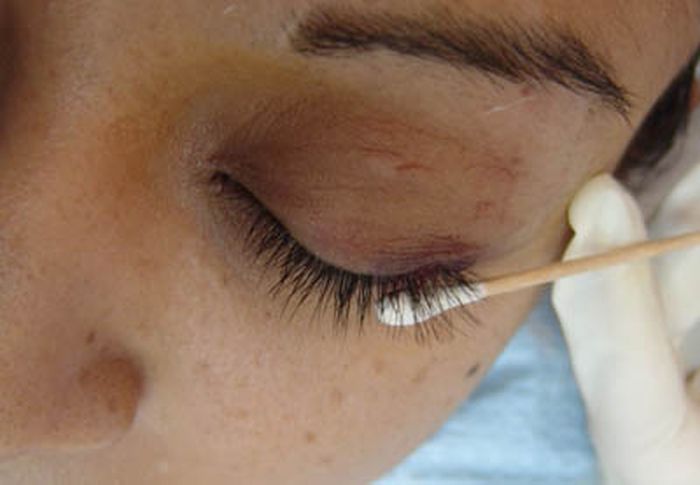 Bizarre Plastic Surgery Procedures (14 pics) Bizarre Plastic Surgery Procedures (14 pics)