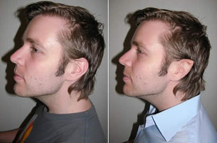 Bizarre Plastic Surgery Procedures (14 pics) Bizarre Plastic Surgery Procedures (14 pics)