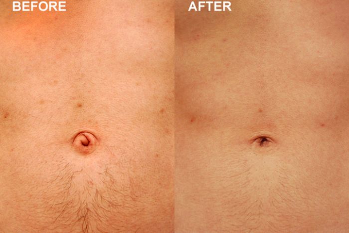 Bizarre Plastic Surgery Procedures (14 pics) Bizarre Plastic Surgery Procedures (14 pics)