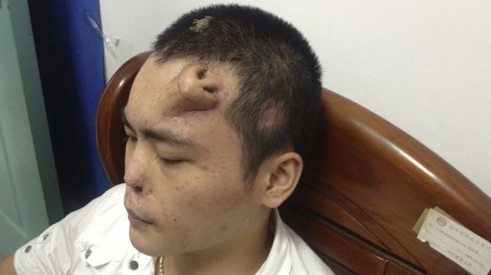 Bizarre Plastic Surgery Procedures (14 pics) Bizarre Plastic Surgery Procedures (14 pics)