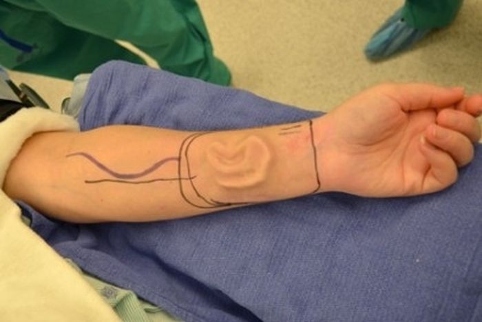 Bizarre Plastic Surgery Procedures (14 pics) Bizarre Plastic Surgery Procedures (14 pics)
