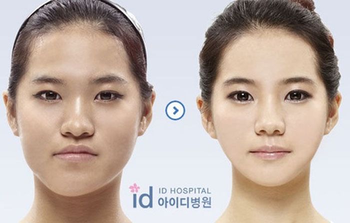 Korean Plastic Surgery. Part 2 (61 pics)