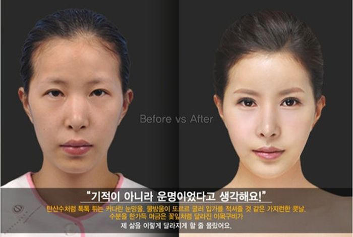 Korean Plastic Surgery. Part 2 (61 pics)