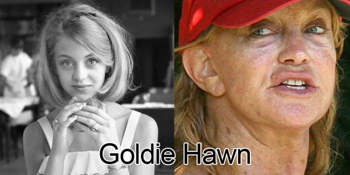 Famous People Then and Now (20 pics)