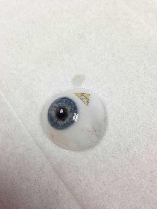 The Making of an Eye Prosthesis (11 pics)