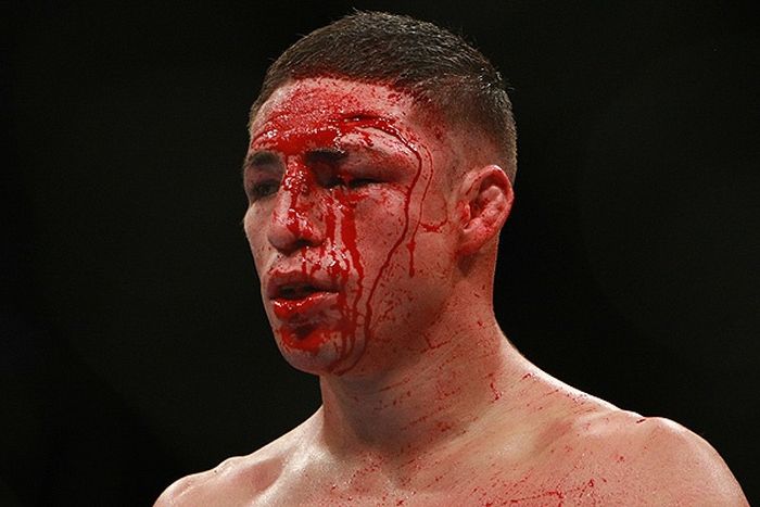 MMA Is Dangerous (23 pics)
