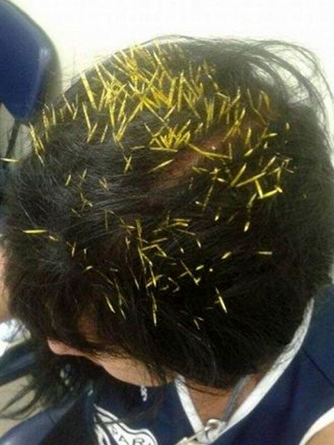 Porcupine Falls from a Lamp Post onto Woman (6 pics)