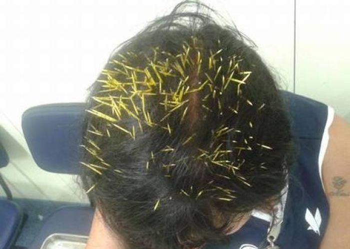 Porcupine Falls from a Lamp Post onto Woman (6 pics)