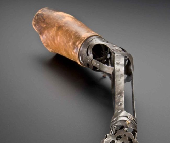 Artificial Arm from the Past (3 pics)
