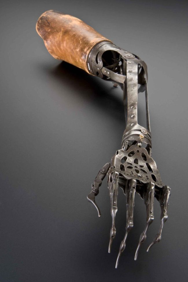 Artificial Arm from the Past (3 pics)
