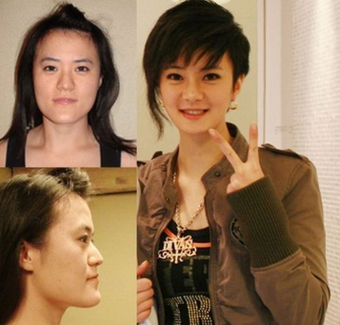 Before and After Plastic Surgery (29 pics)