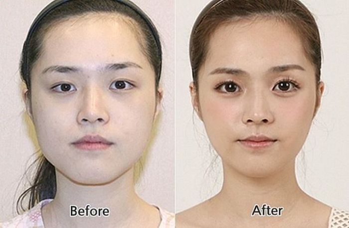 Before and After Plastic Surgery (29 pics)