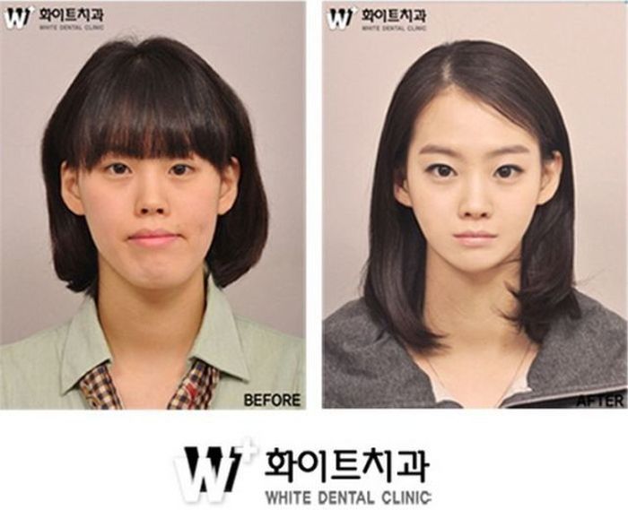 Before and After Plastic Surgery (29 pics)